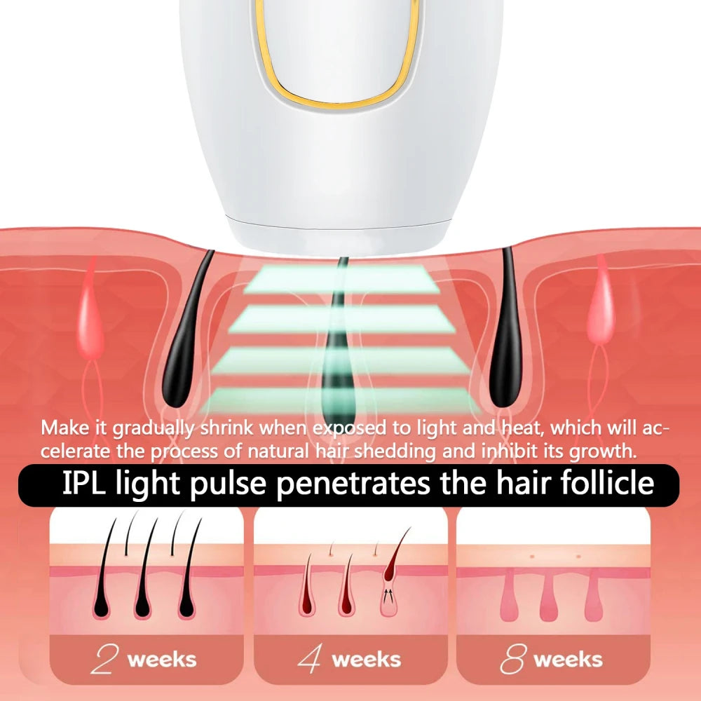 At-Home Pulse Light Hair Remover